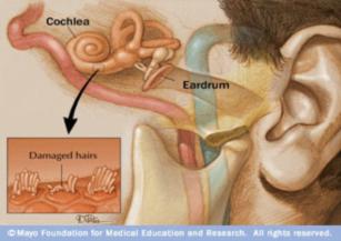 ZD治疗为什么很贵耳鸣的原因及治疗_https://www.jmylbn.com_新闻资讯_第1张